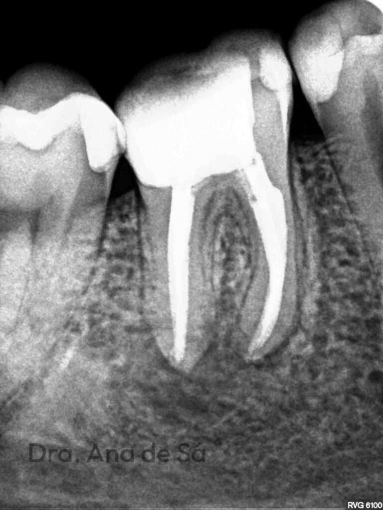 endodontia